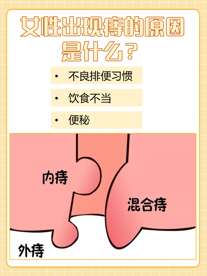 关于痔疮症状女性的信息 关于痔疮症状女性的信息（关于痔疮症状女性的信息有哪些） 女性
