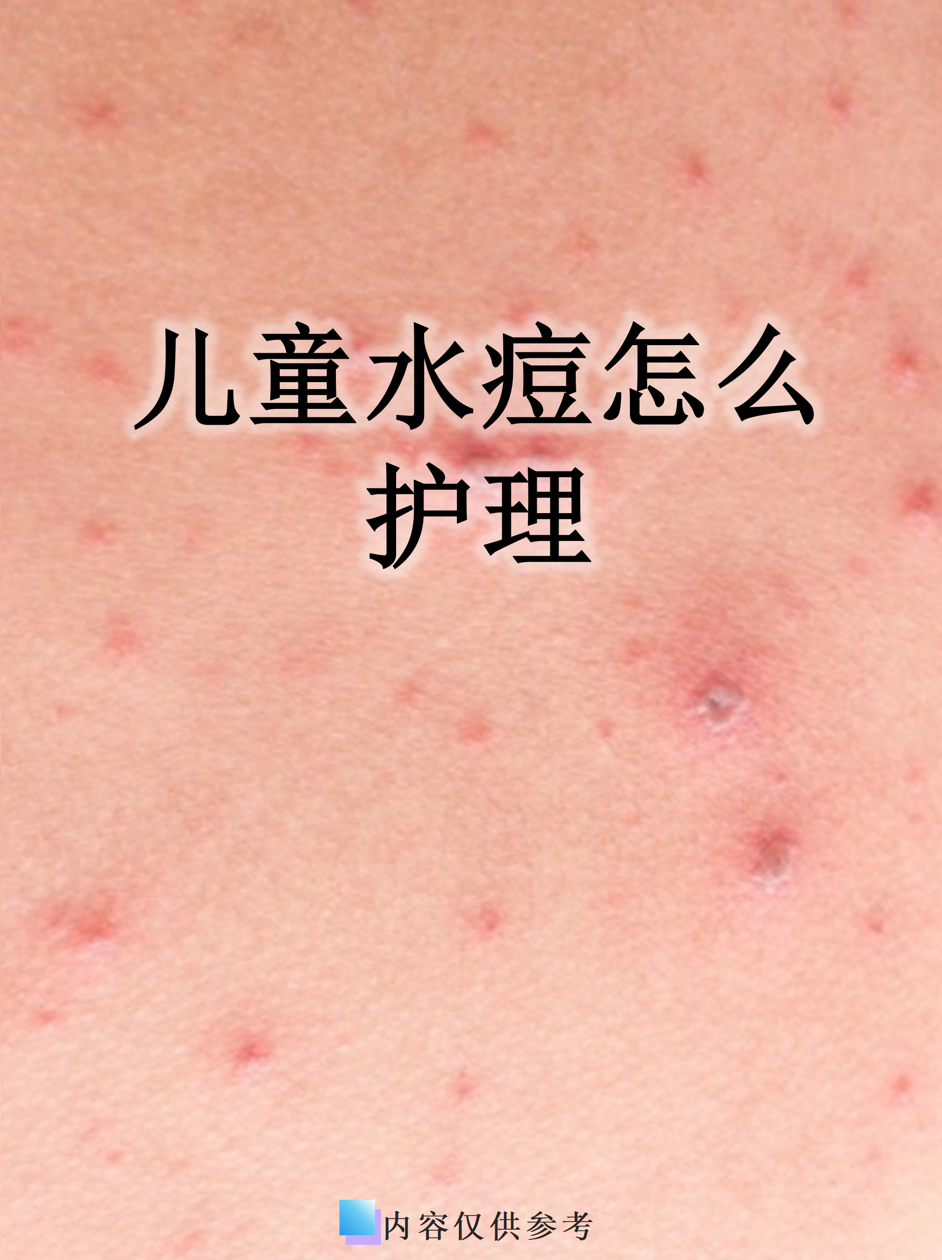 儿童水痘是一种常见的传染性疾病,护理得当能帮助
