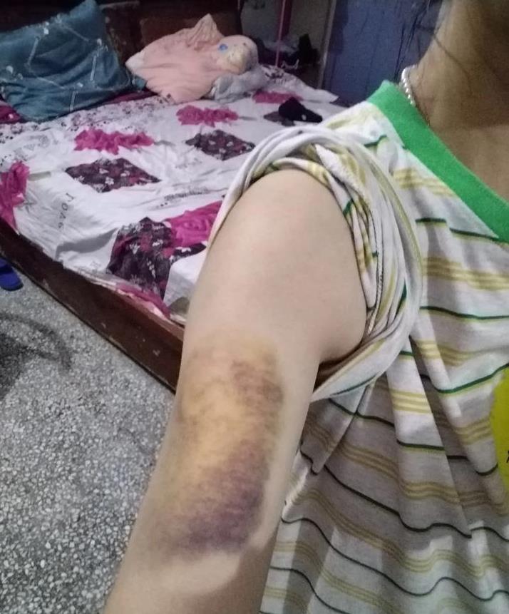 我居然也会被家暴!昨天我还在想,这辈子都不可能轮到我摊上这事儿