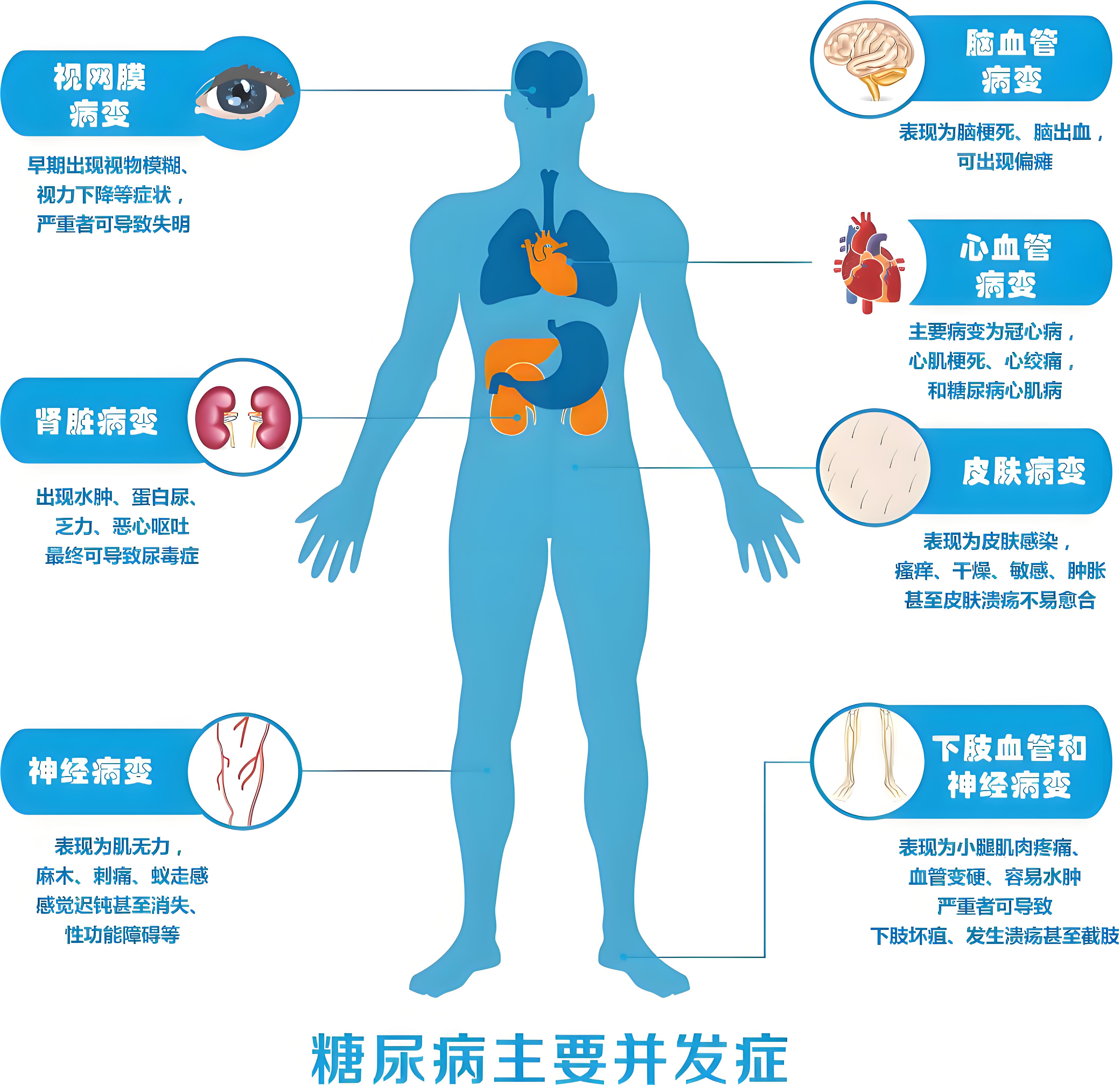 糖尿病并发症会导致图片