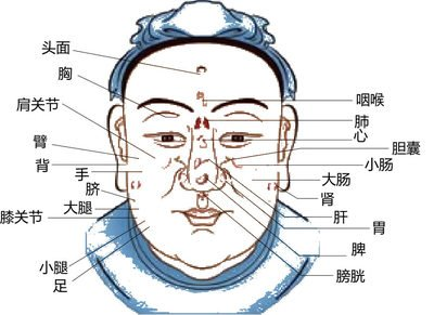 两边颧骨长斑——肝失疏泄,气滞血瘀
