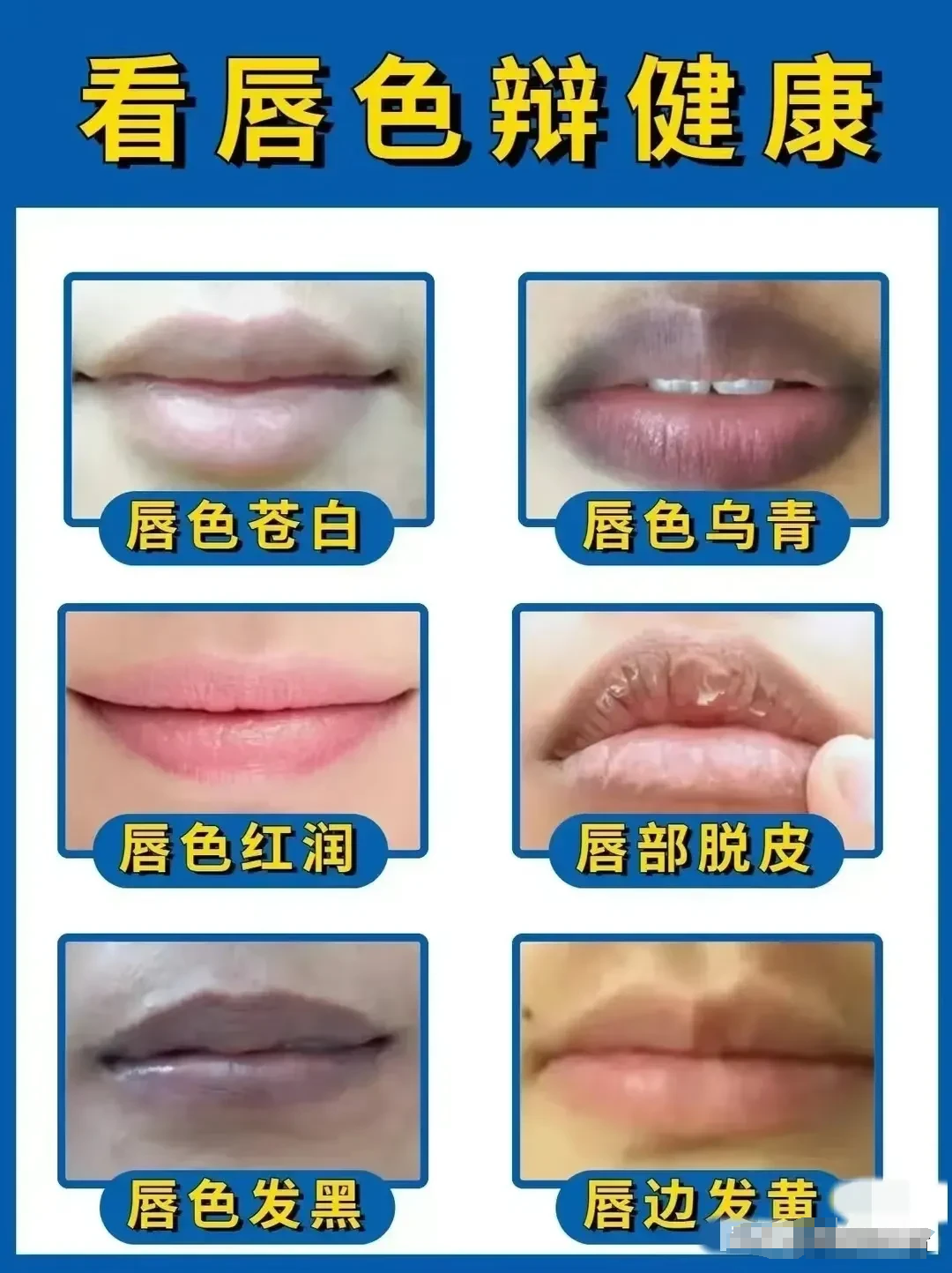 缺血的嘴唇图片气血不足的嘴唇颜色嘴唇症状对比图唇四白健康的图片