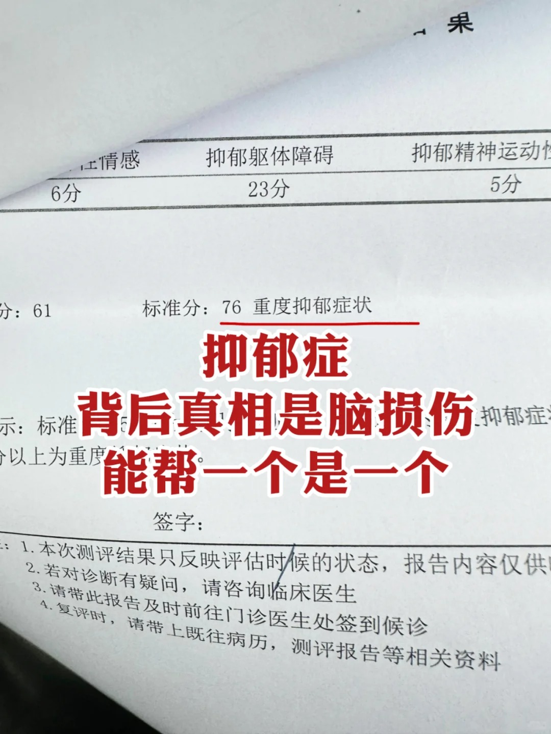 医生能不能看出假装抑郁(一图看懂真假抑郁症)