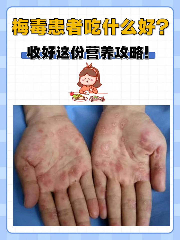 梅毒患者吃什么好?收好这份营养攻略!