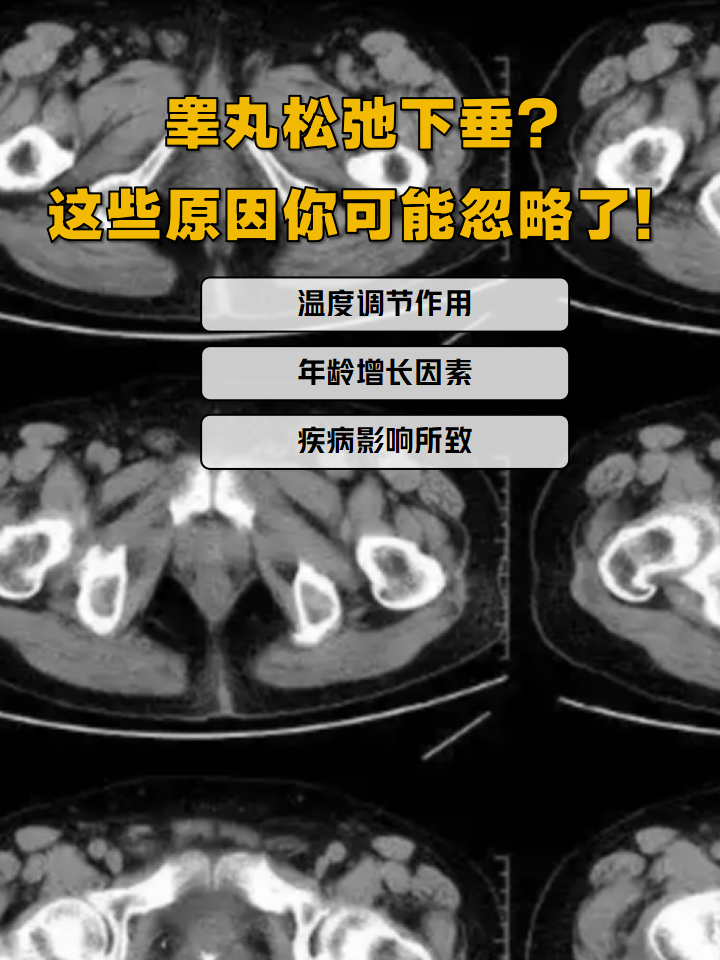 为什么男人的蛋蛋会下垂为什么在线