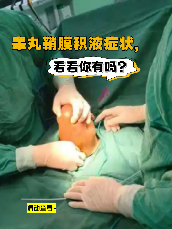 睾丸鞘膜积液是因鞘膜腔内液体异常积聚导致,下面来看看具体症状和