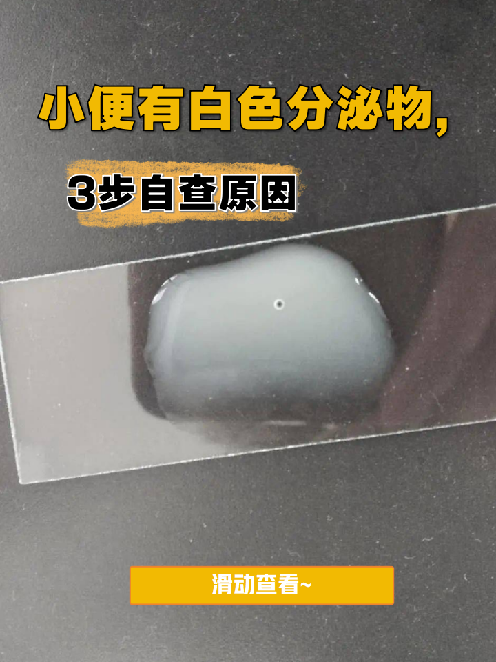 小便有白色分泌物,3步自查原因