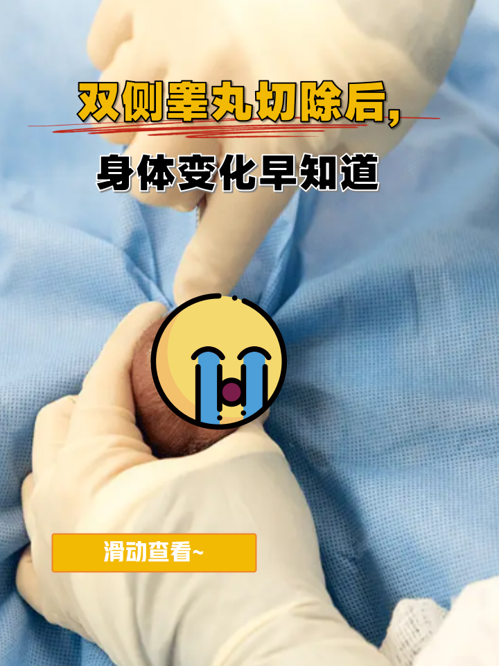 双侧睾丸切除后,身体变化早知道