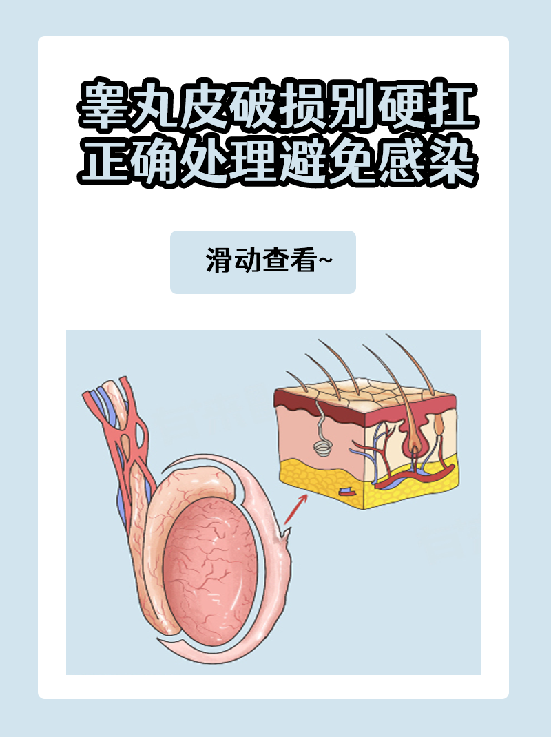 睾丸皮破损别硬扛,正确处理避免感染