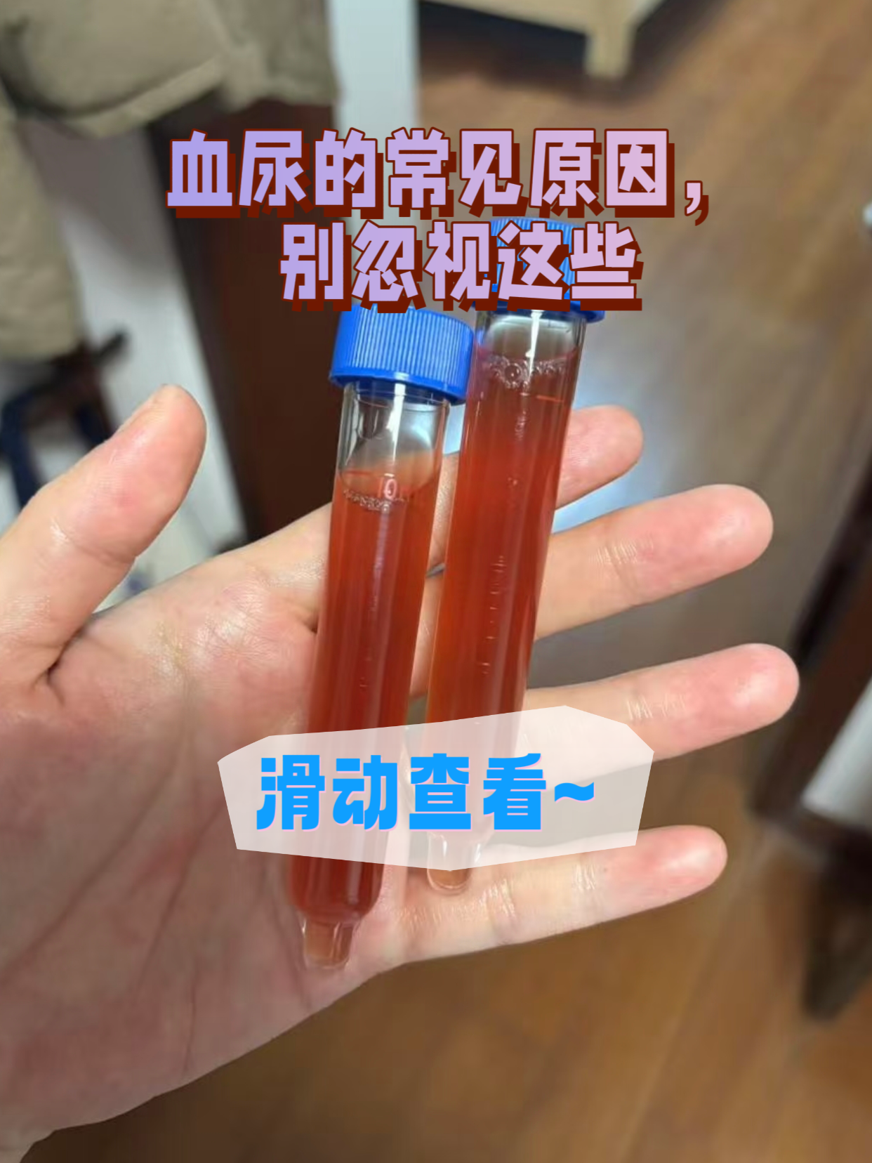 血尿的常见原因,别忽视这些