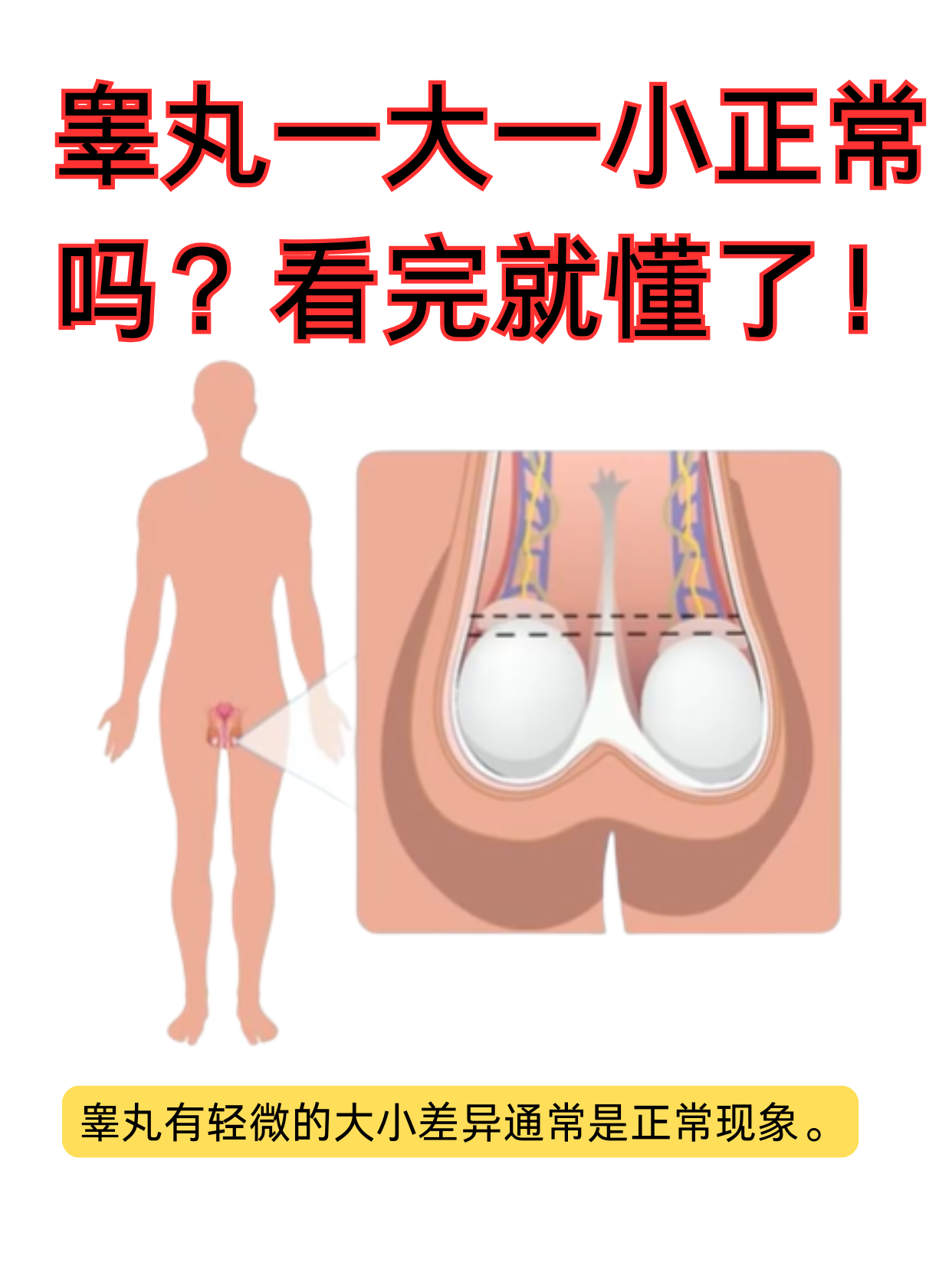 夏天穿短裤时,有些男性可能会无意间发现两侧