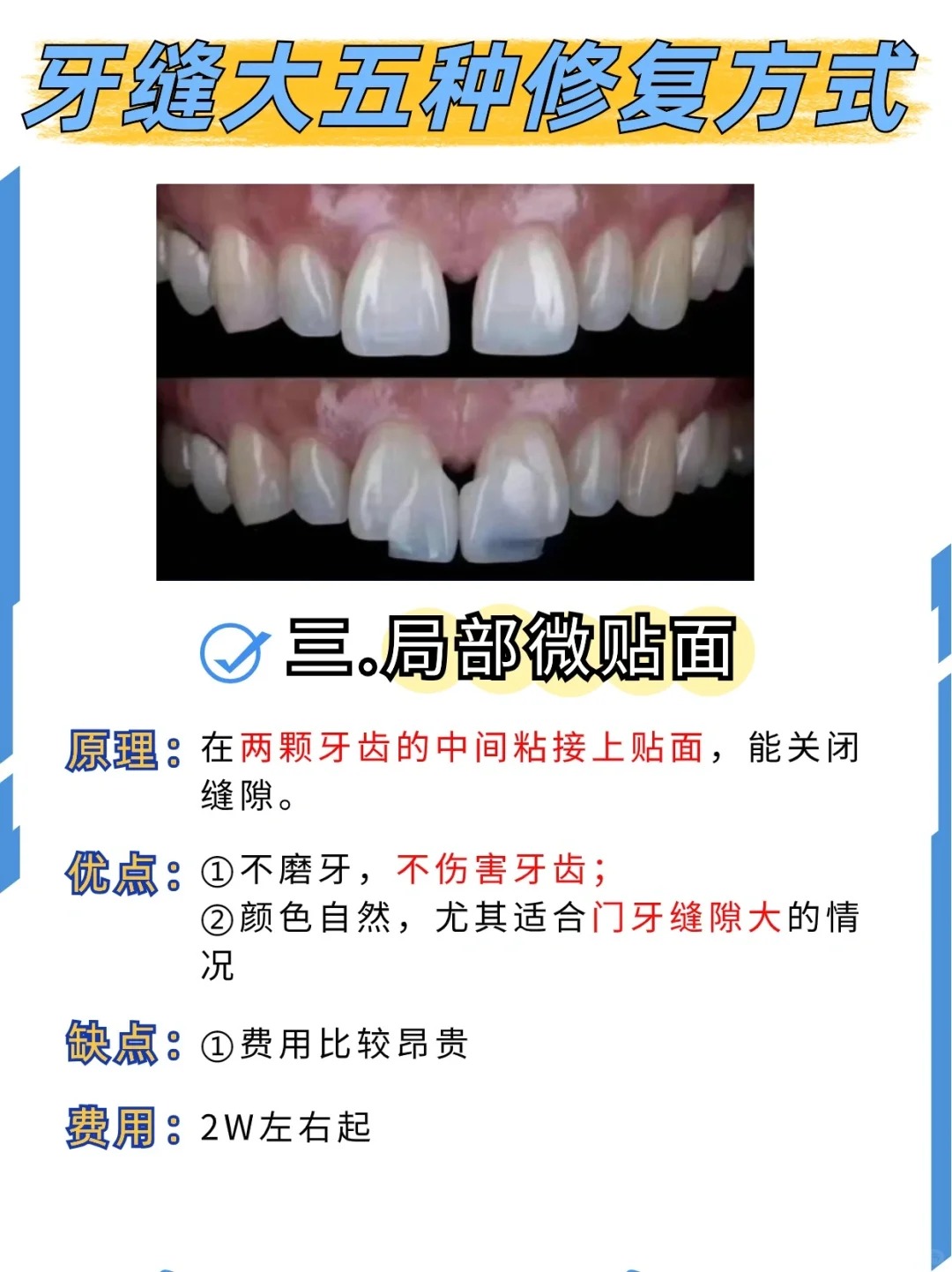 五种修复方式优缺点大总结