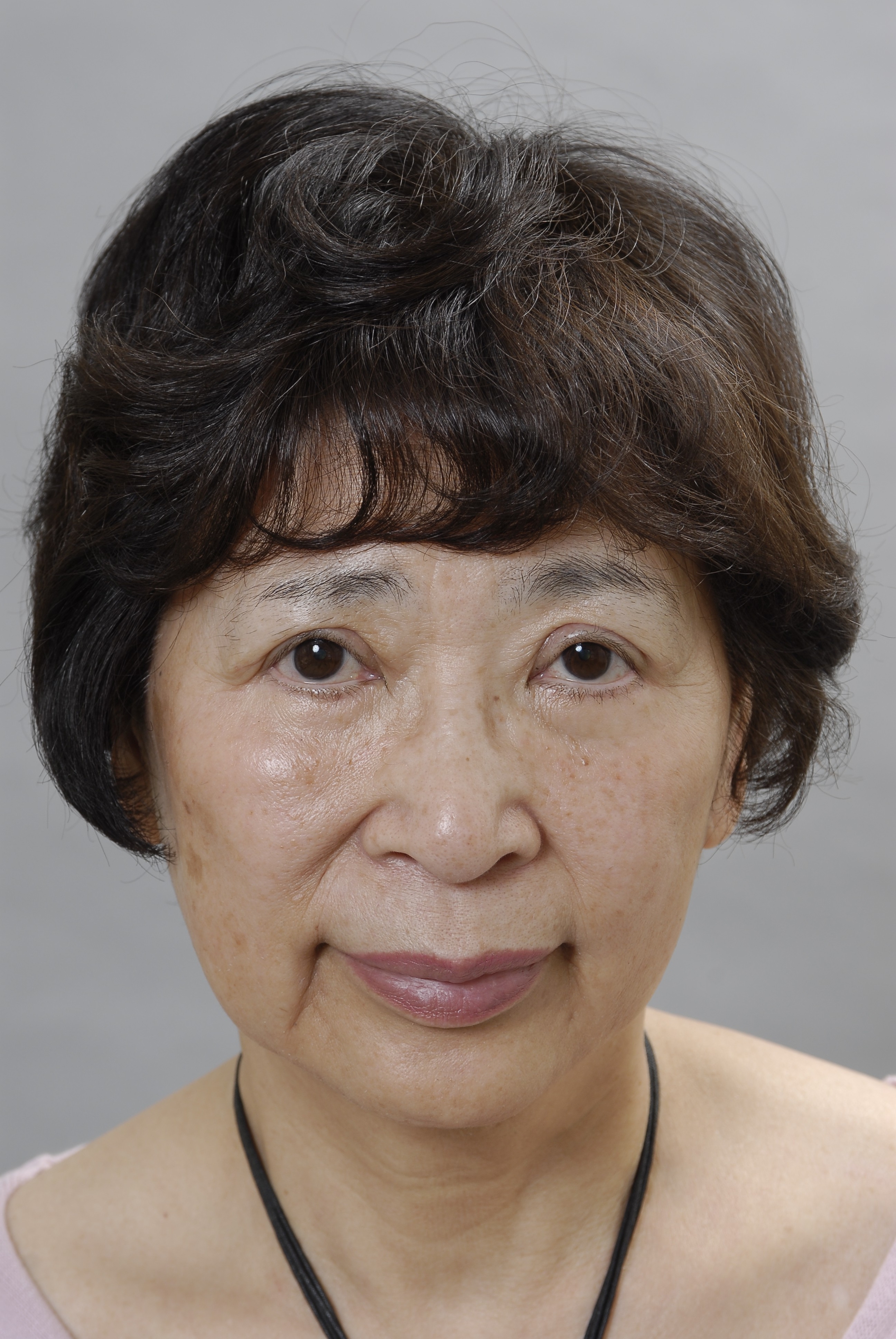 南京53岁老板娘,一掷千金大换脸!拉皮术后45天,不料变成了这副模样