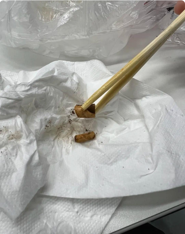 加班饿了就出去吃了碗馄饨,结果准备吃就看到了这个