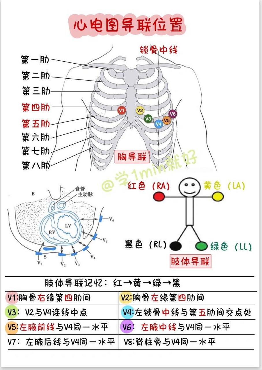 1min学习|心电图导联位置98  98肢体导联:(记忆:红→黄→绿→黑)