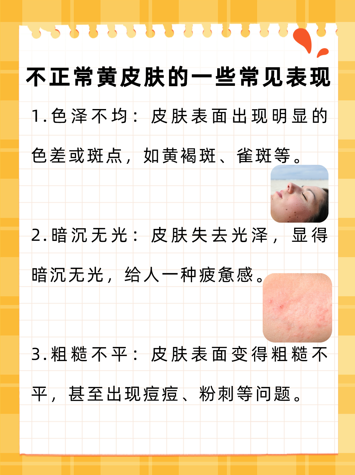 为什么皮肤暗黄无光泽