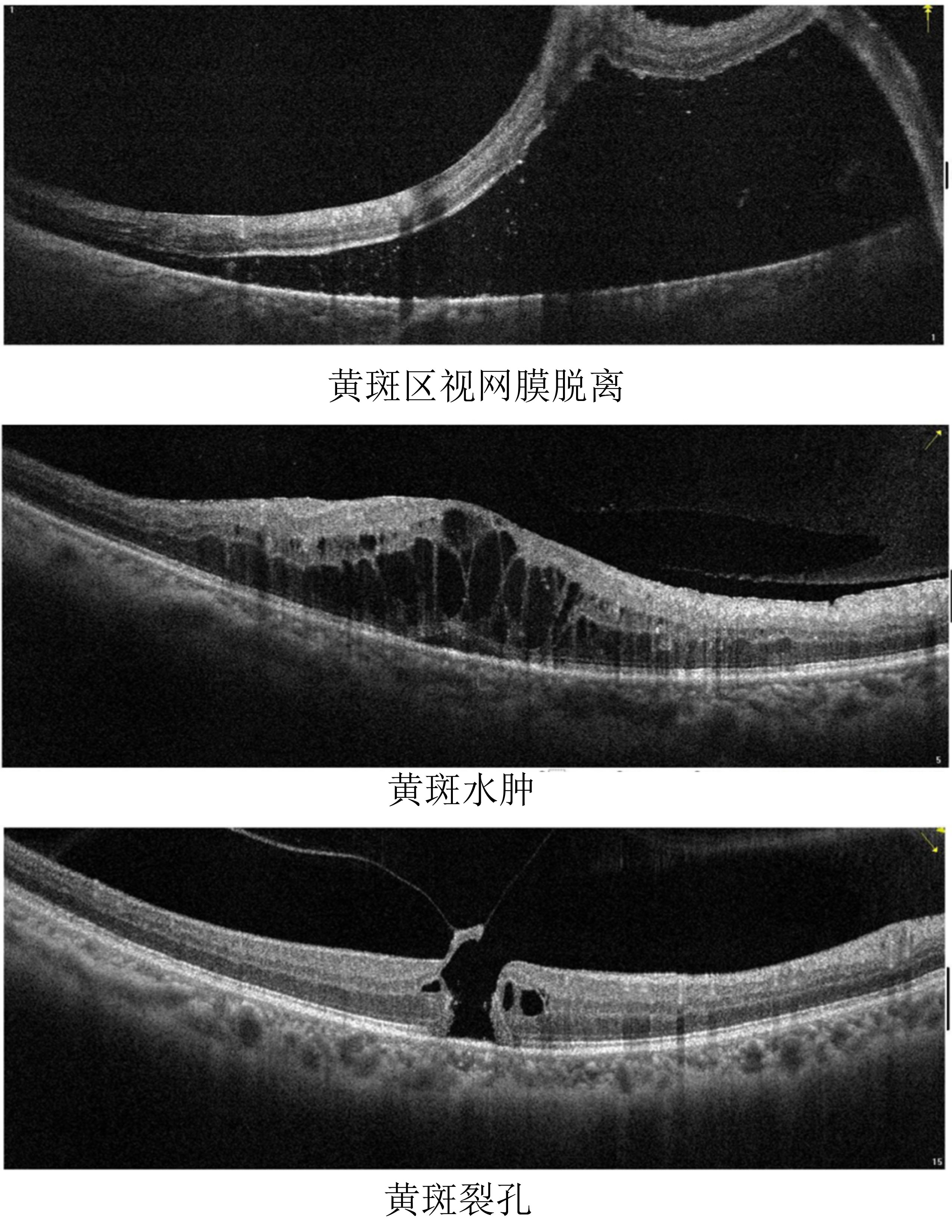 eyecontact图片