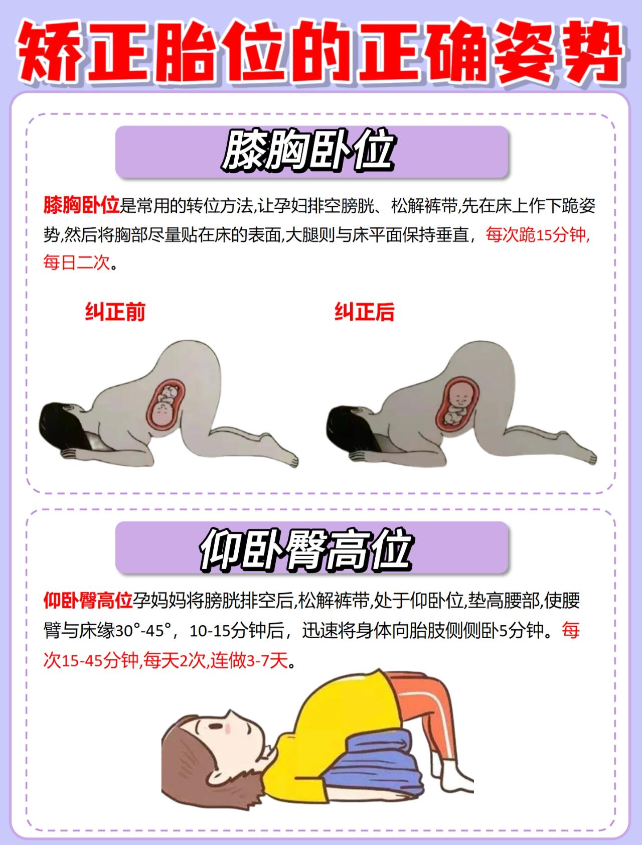胎位不正是指胎儿在子宫中的位置不是正常的头位,主要包括臀位,横位