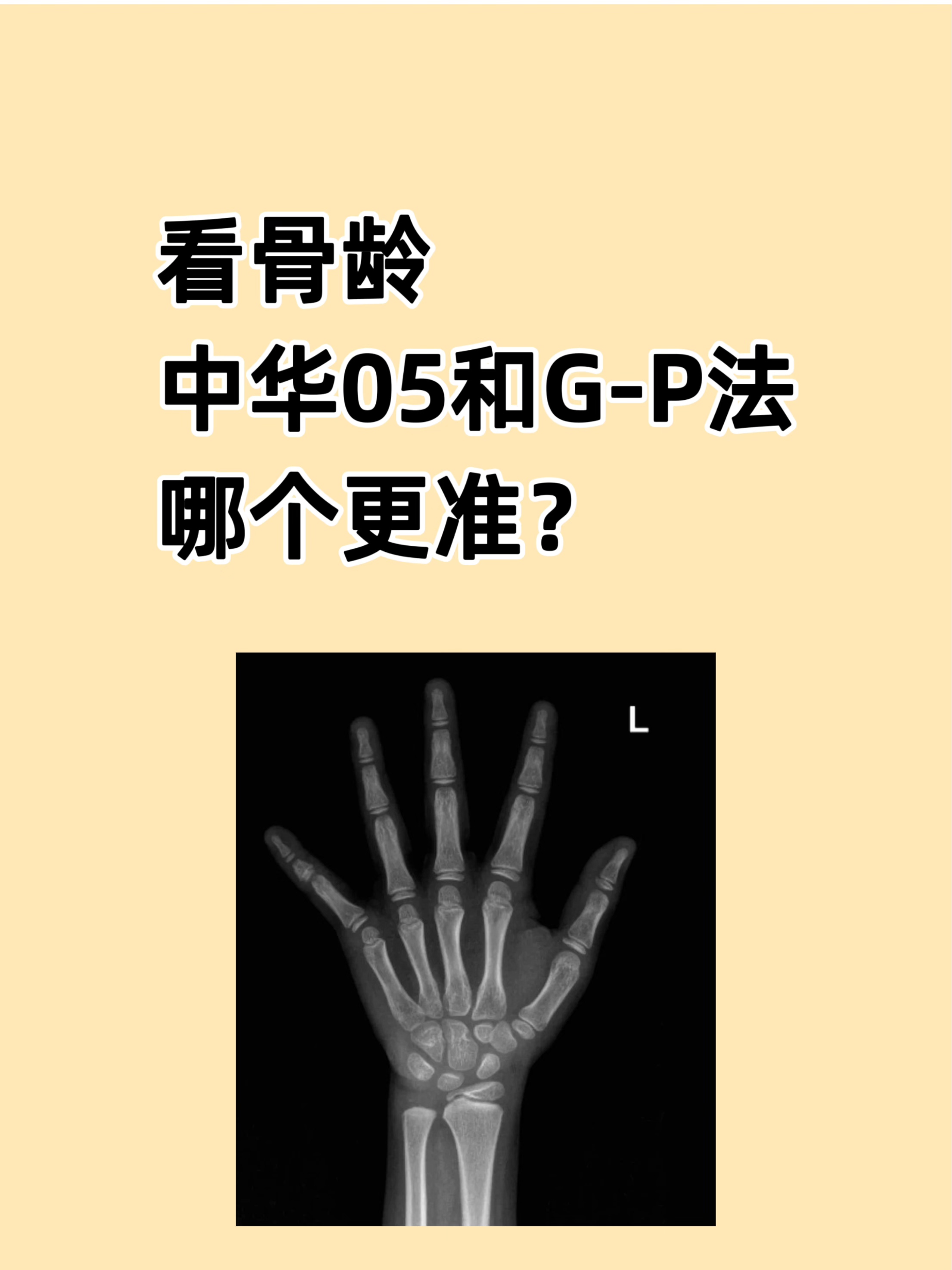 简单说给中国孩子看骨龄中华05法比g