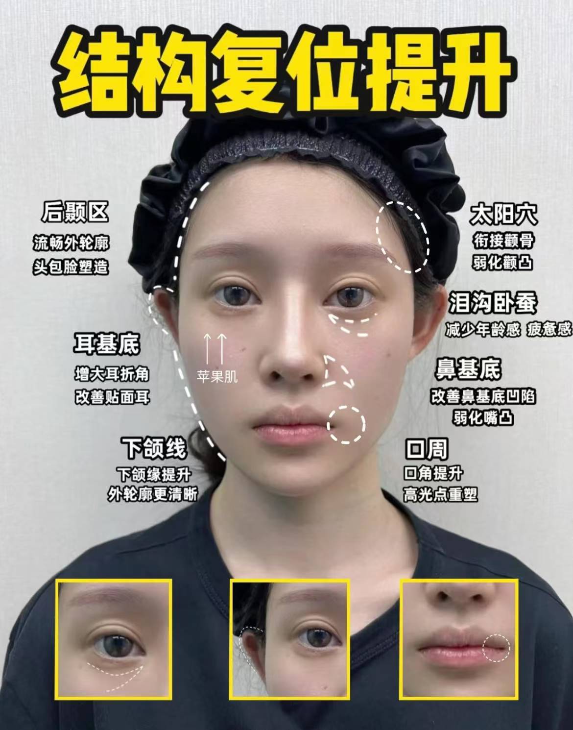 很多小姐姐在变美的过程中都执着于一些细节例如泪沟细纹黑眼圈等