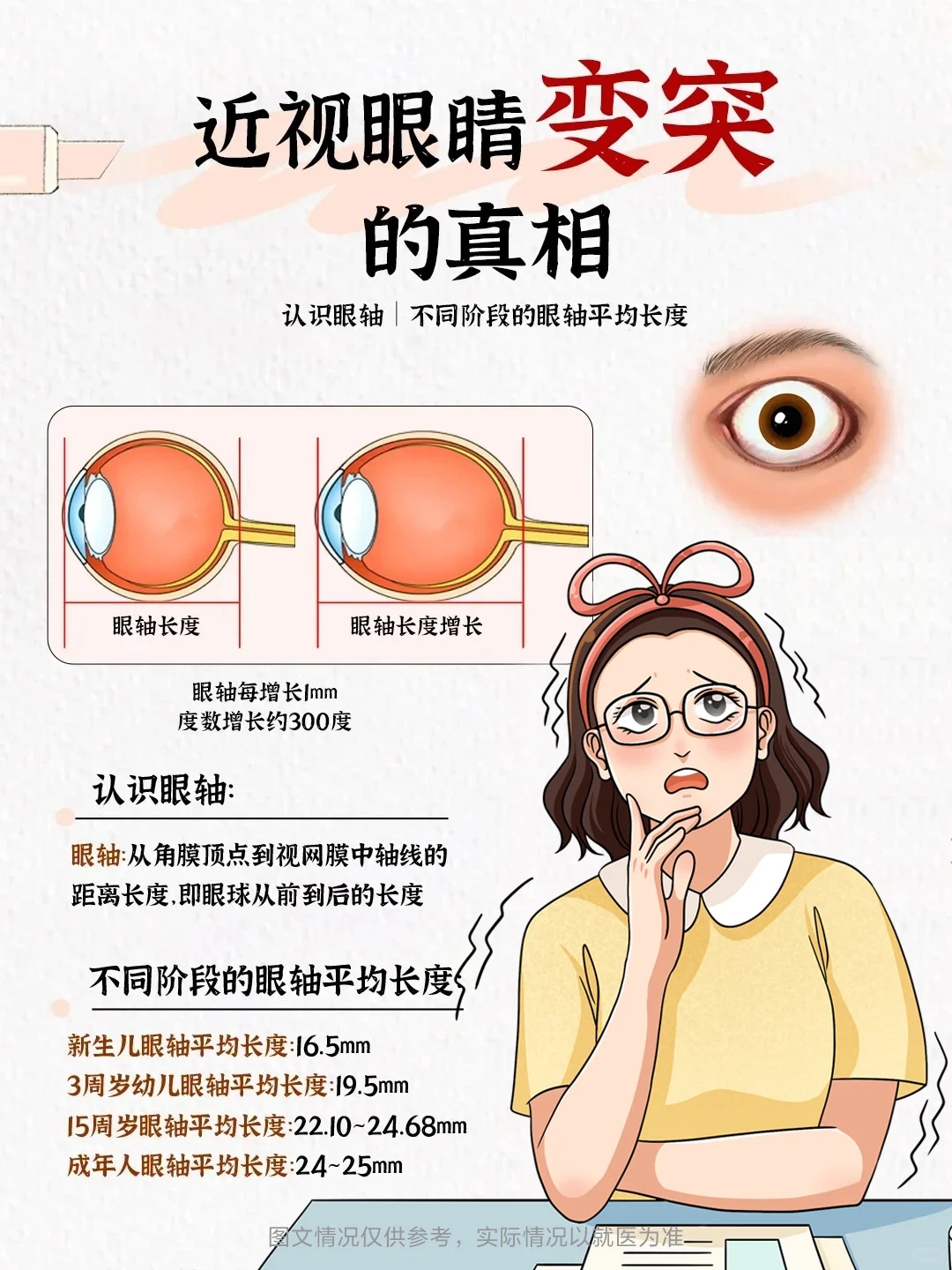 眼球会凸出来高度近视戴眼镜的样子戴眼镜会改变眼睛的形状吗眼轴增长