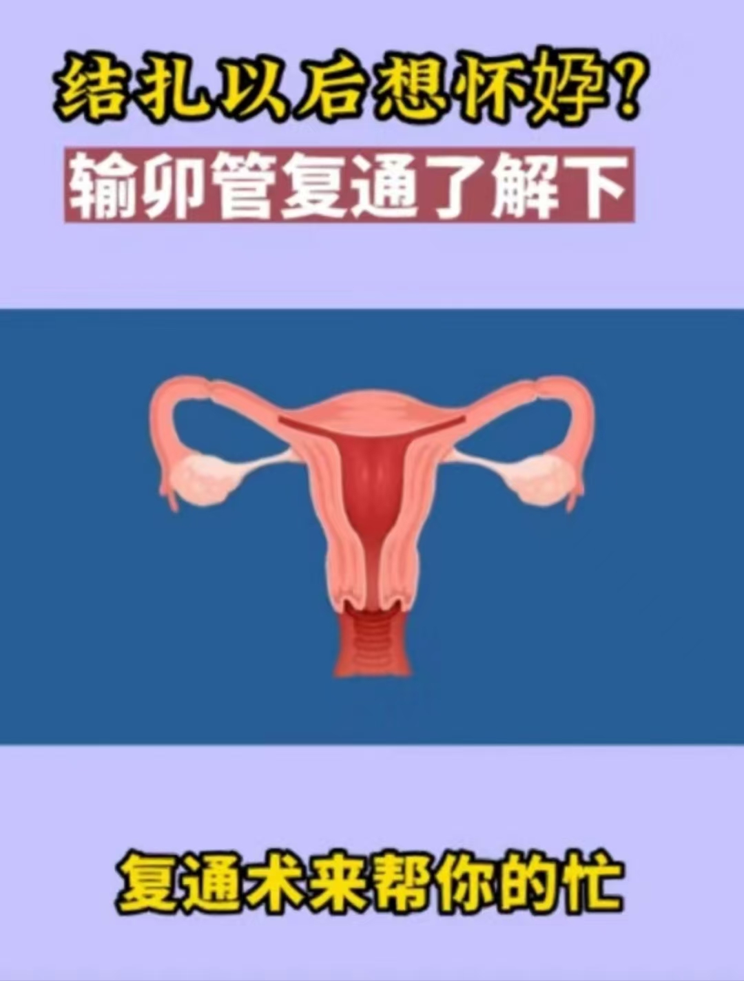 女性结扎手术 图解图片