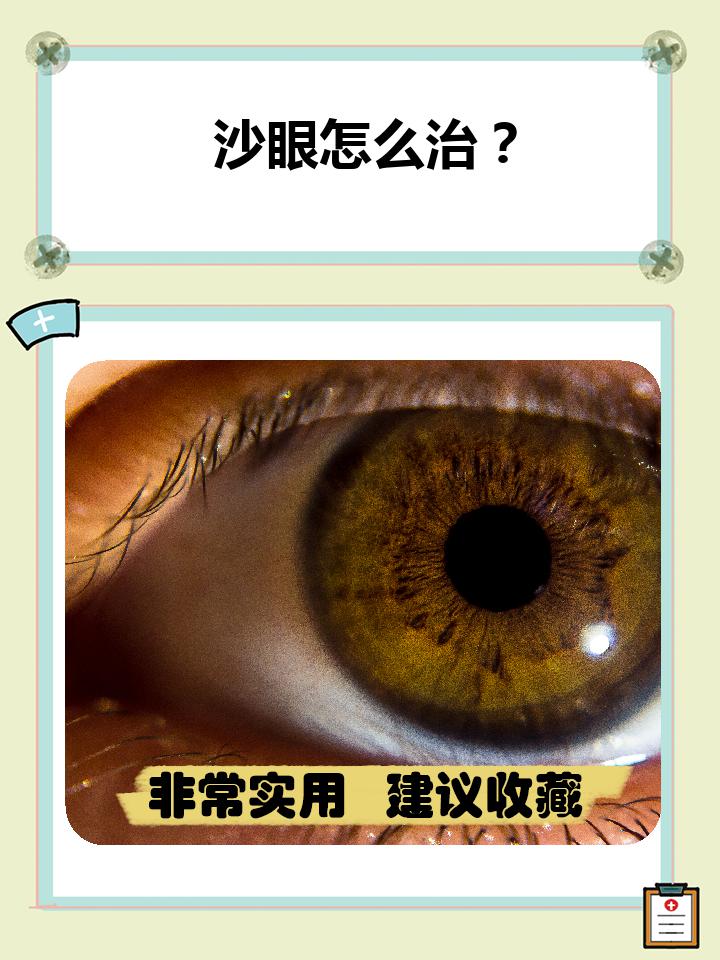 别担心,治疗沙眼并不复杂,但需要及时和正确的方法
