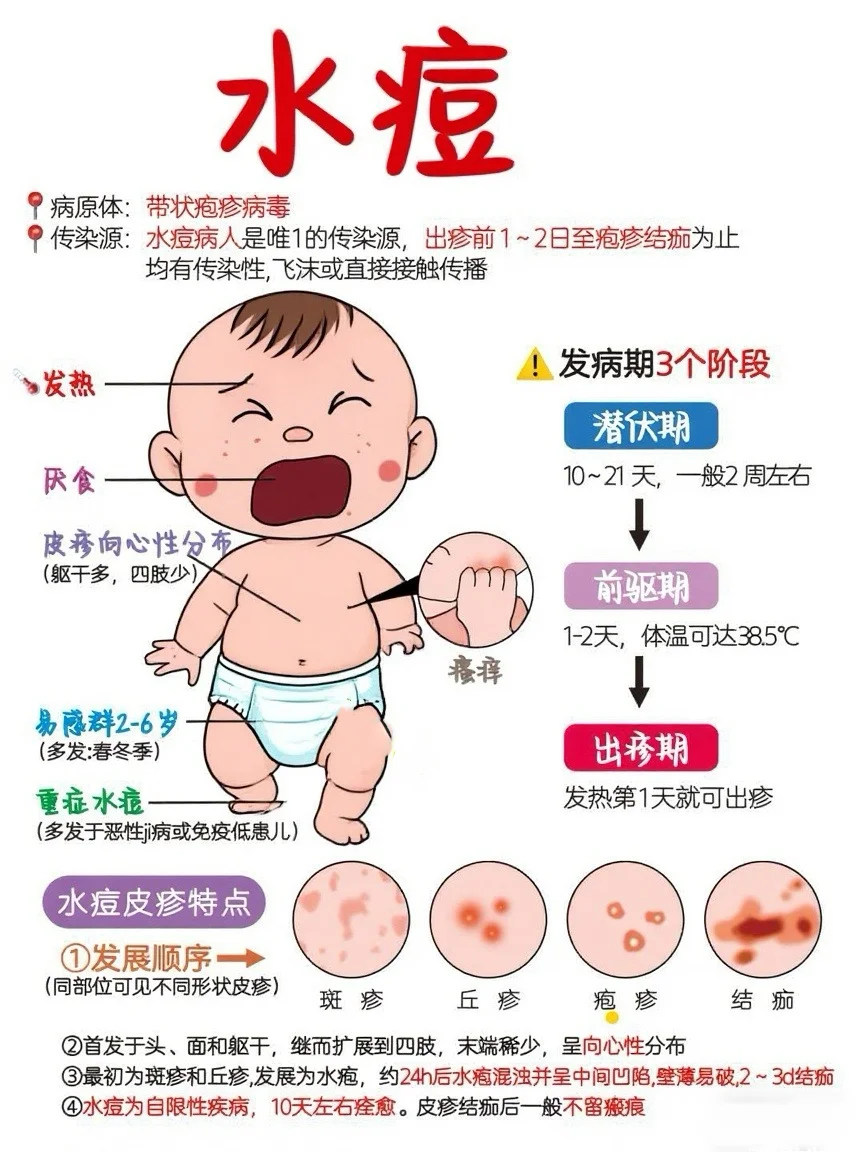 接触水痘患者后,一般观察10到21天能排除感染