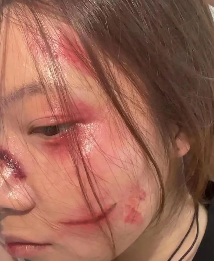 贵州女子刚刚经历了剖腹产的勇敢母亲,身体还未从手术的创伤中