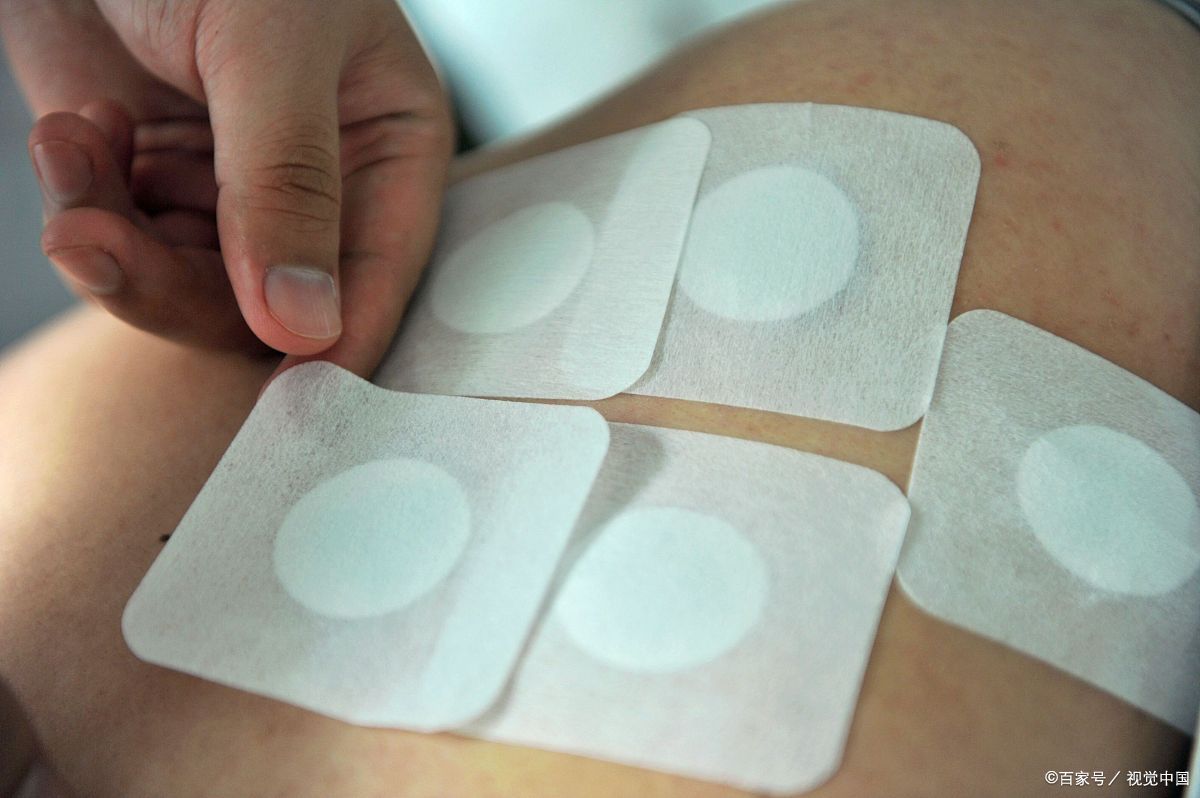 什么是三九天灸 三九天灸是指在冬季三九天进行的天灸疗法