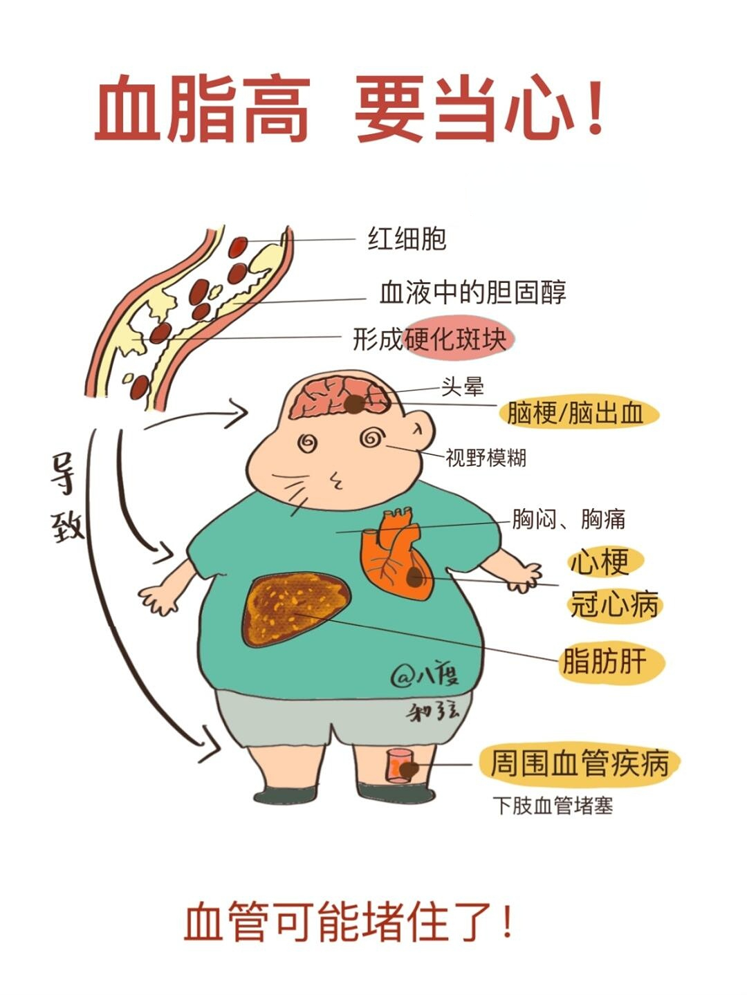 医生讲述:高血脂患者降脂期间,要避免几个误区,以免出现并发症