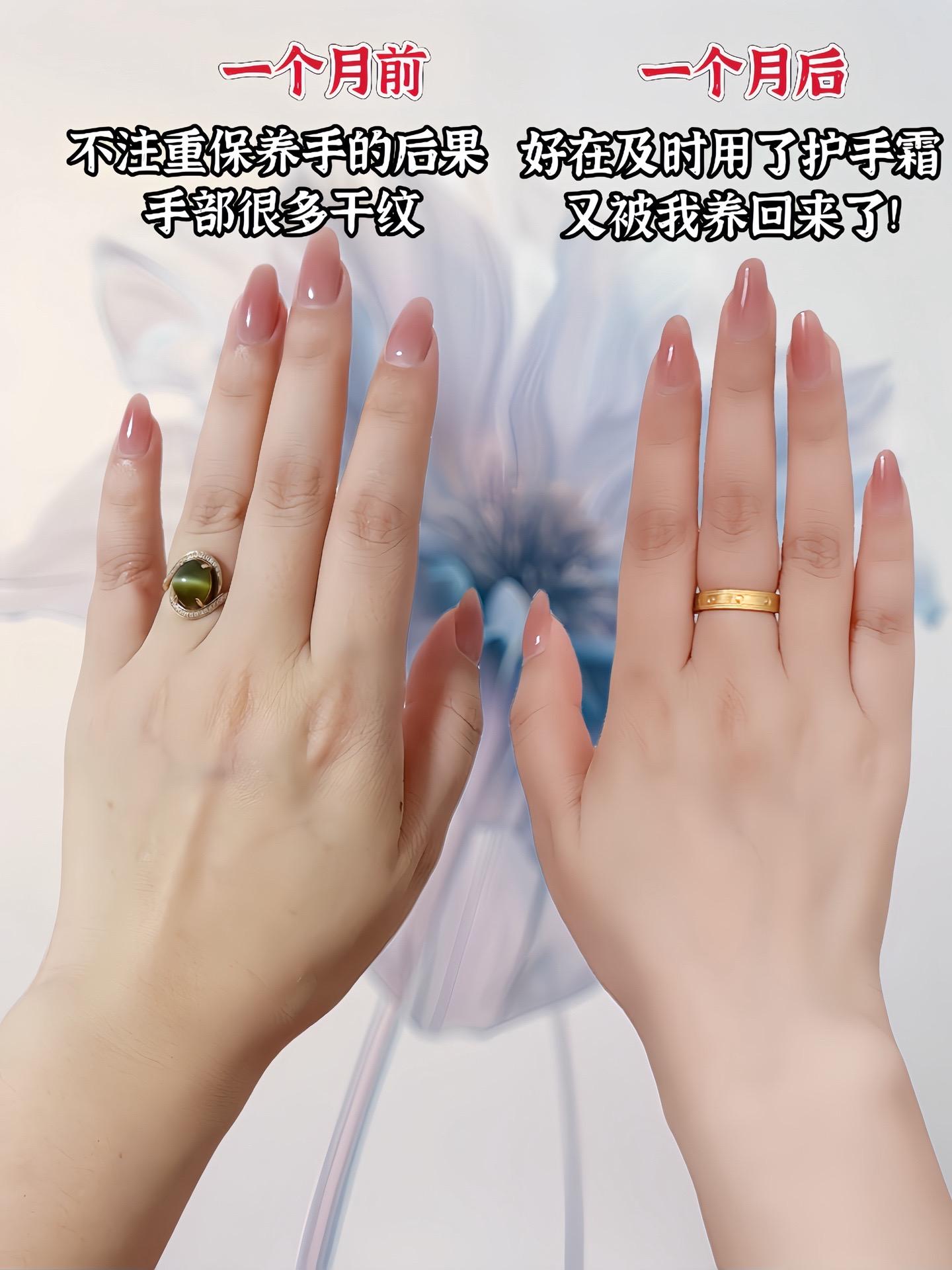对比类# 【秋冬护手大作战】