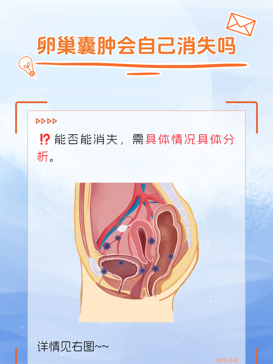 卵巢囊肿会自己消失吗?