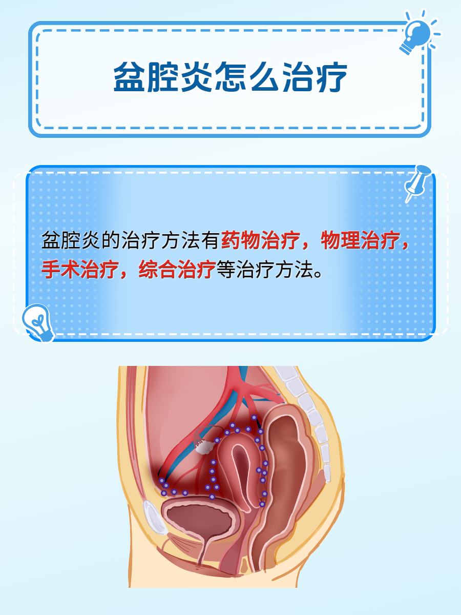 盆腔炎怎么治疗?揭秘!