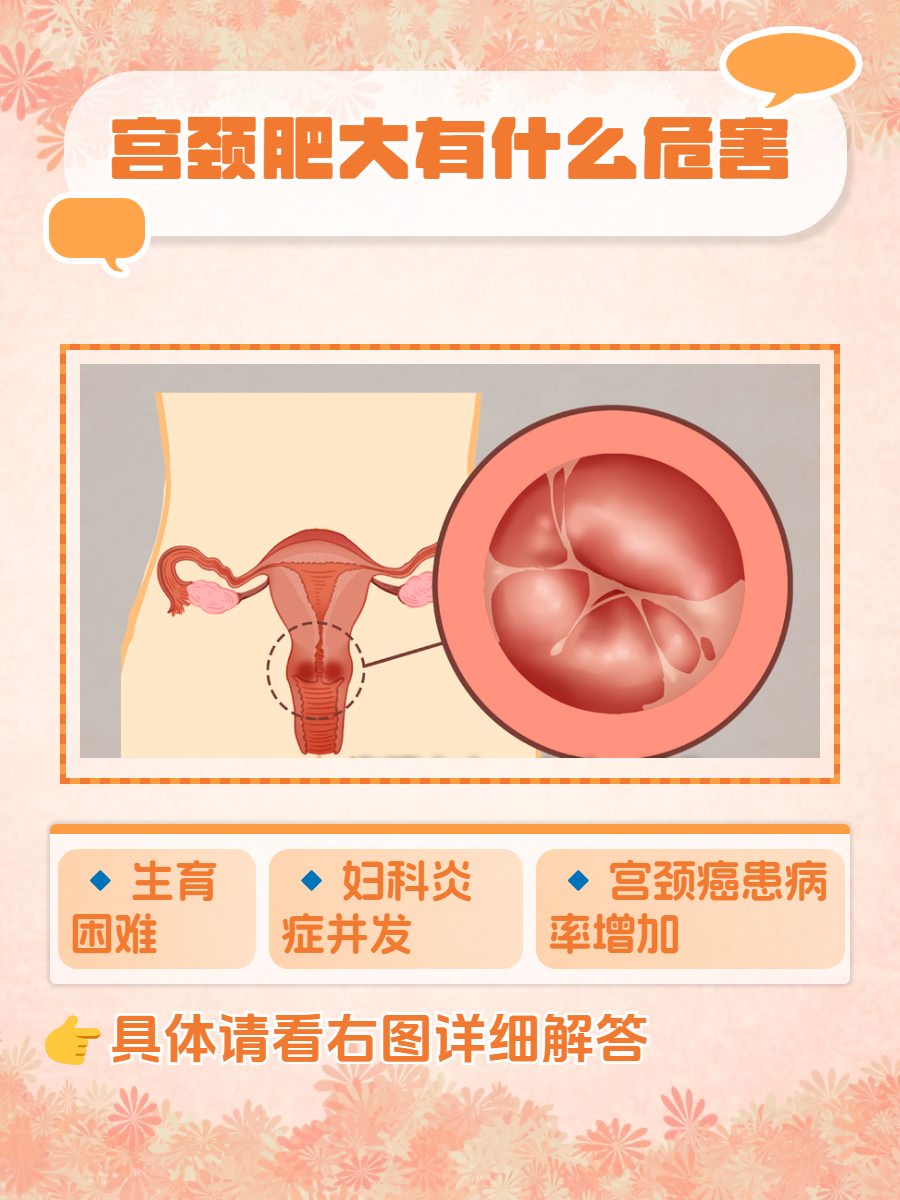 女人子宫外部 肥大图片