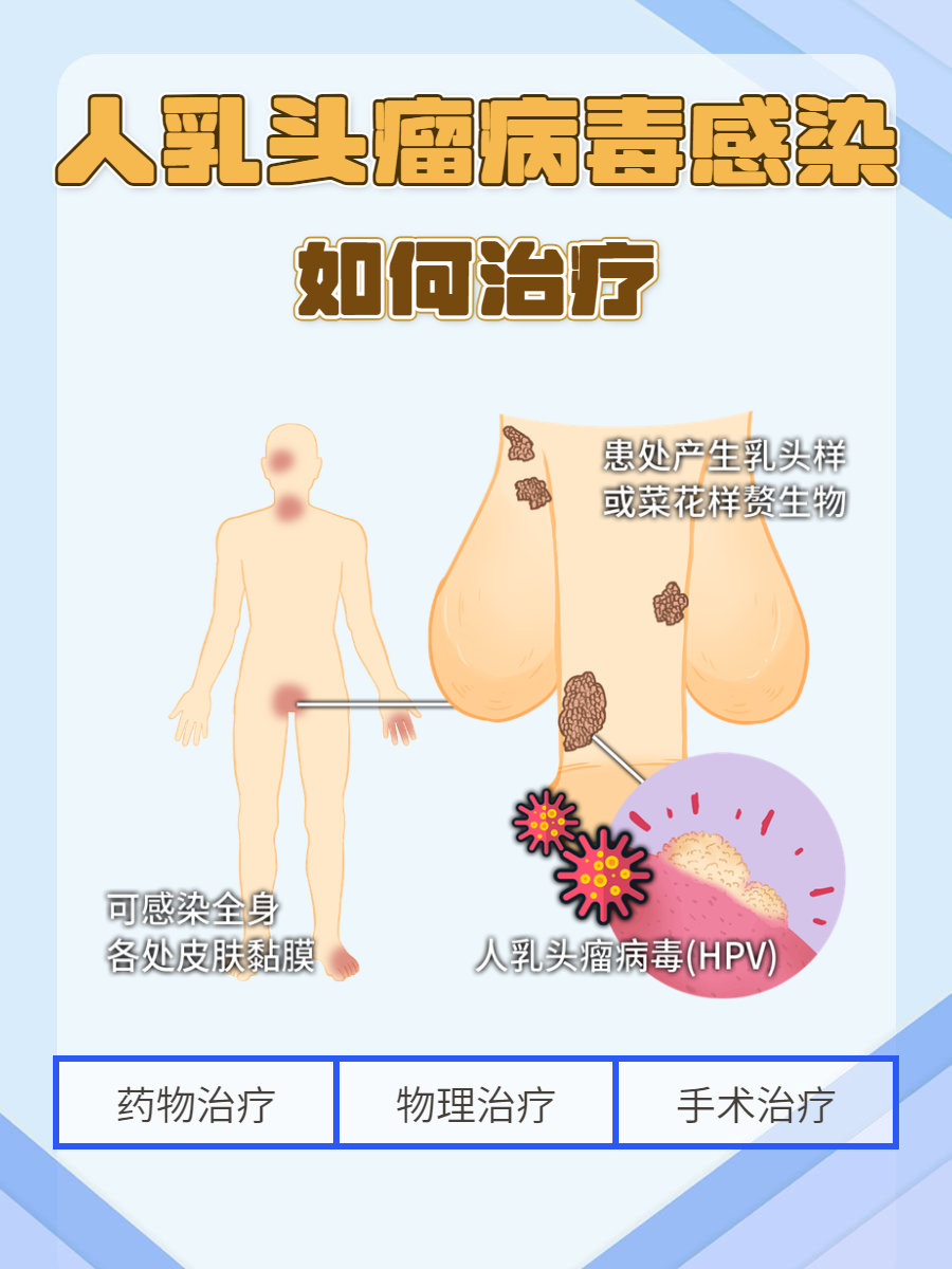 病毒感染最佳治疗方法