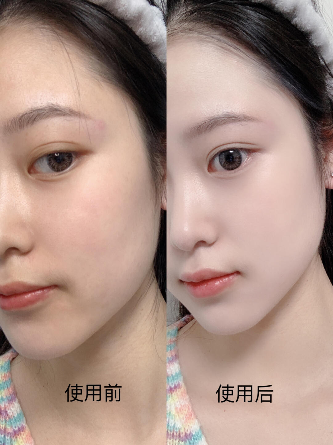 肤质区分