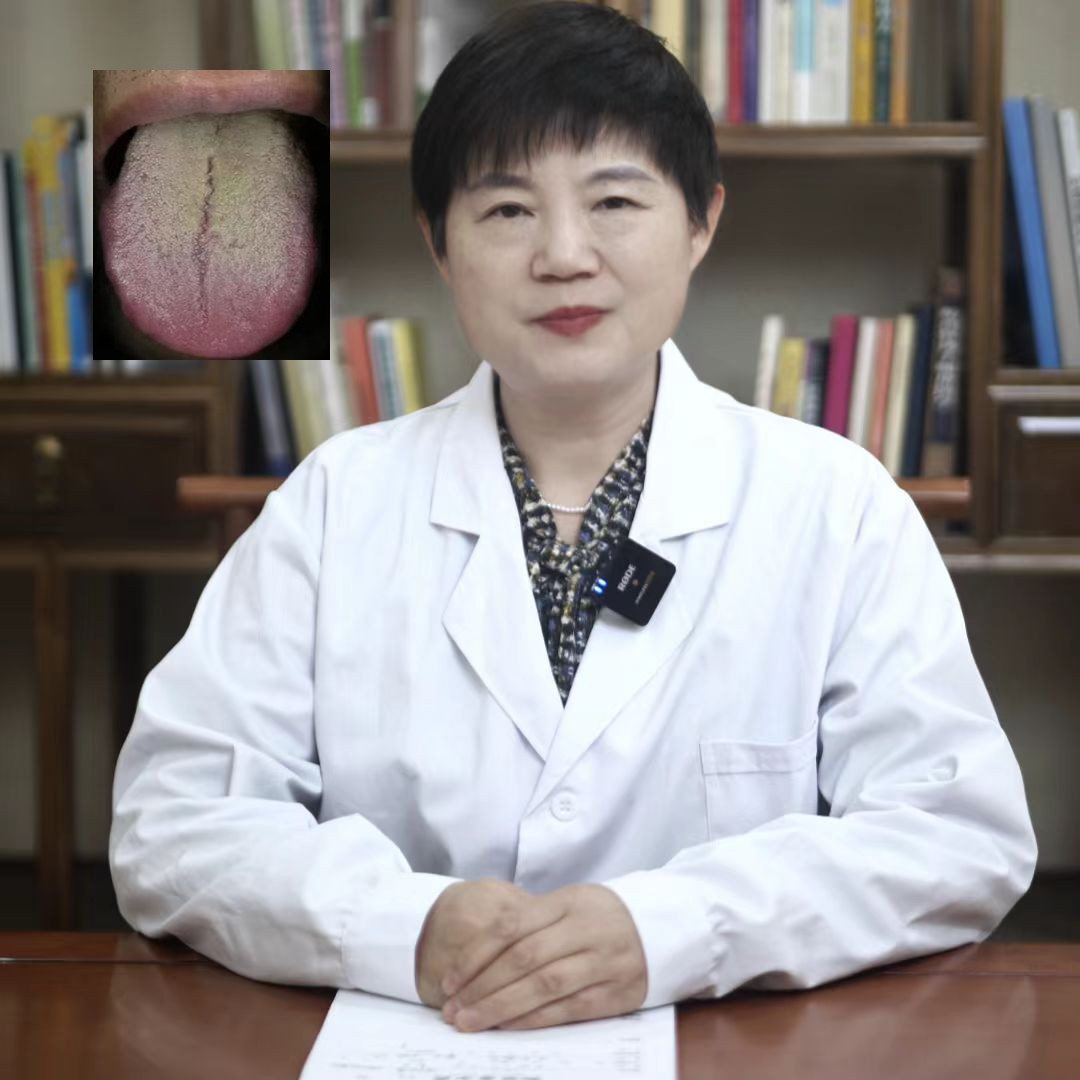 这种舌象心肝火,脾胃湿,下焦热,一个不少!