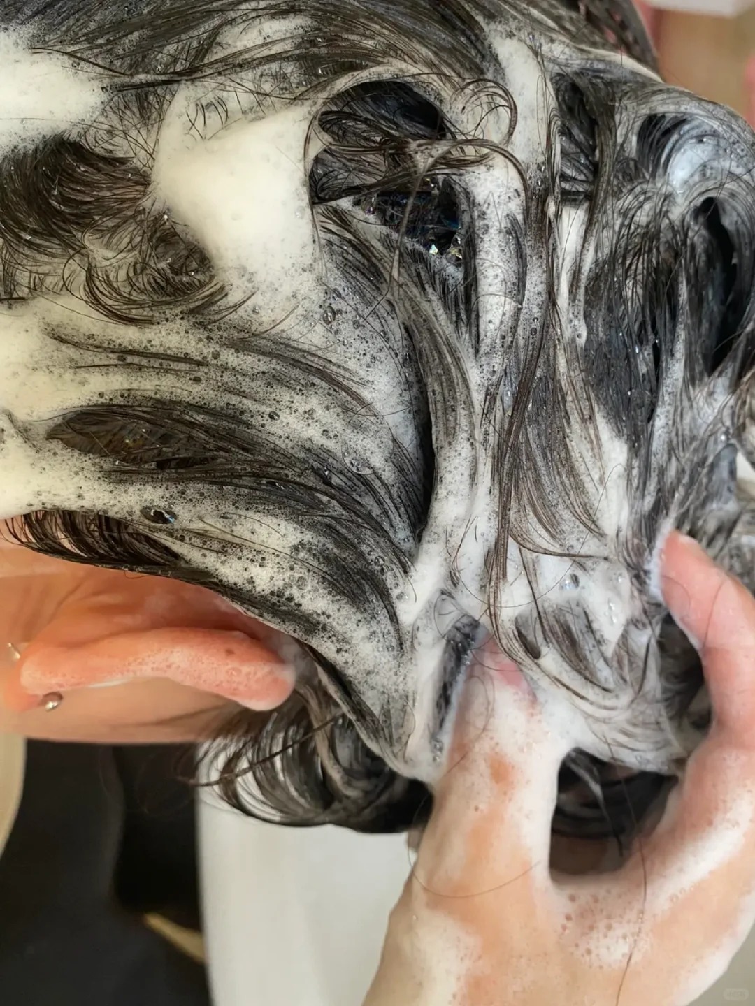 直到我尝试了花诉妍专业去屑洗发水我才发现头皮屑问题真的可以被