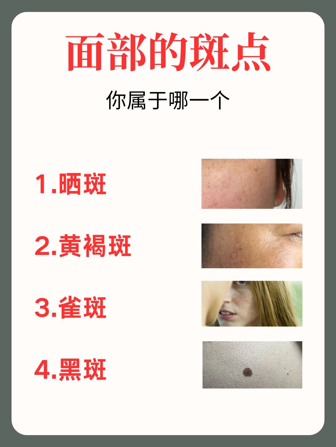 化色斑其次可以补充花 康月可改变晦暗气色化解黄褐斑使皮肤细腻