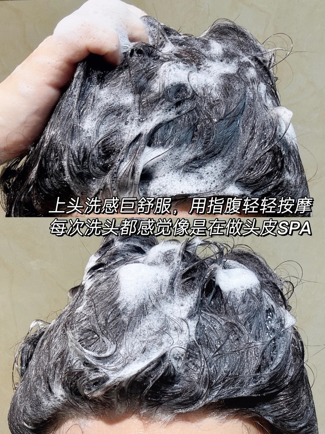 我的一个朋友因为头屑问题让人家以为她从未洗过头一直被人开玩笑