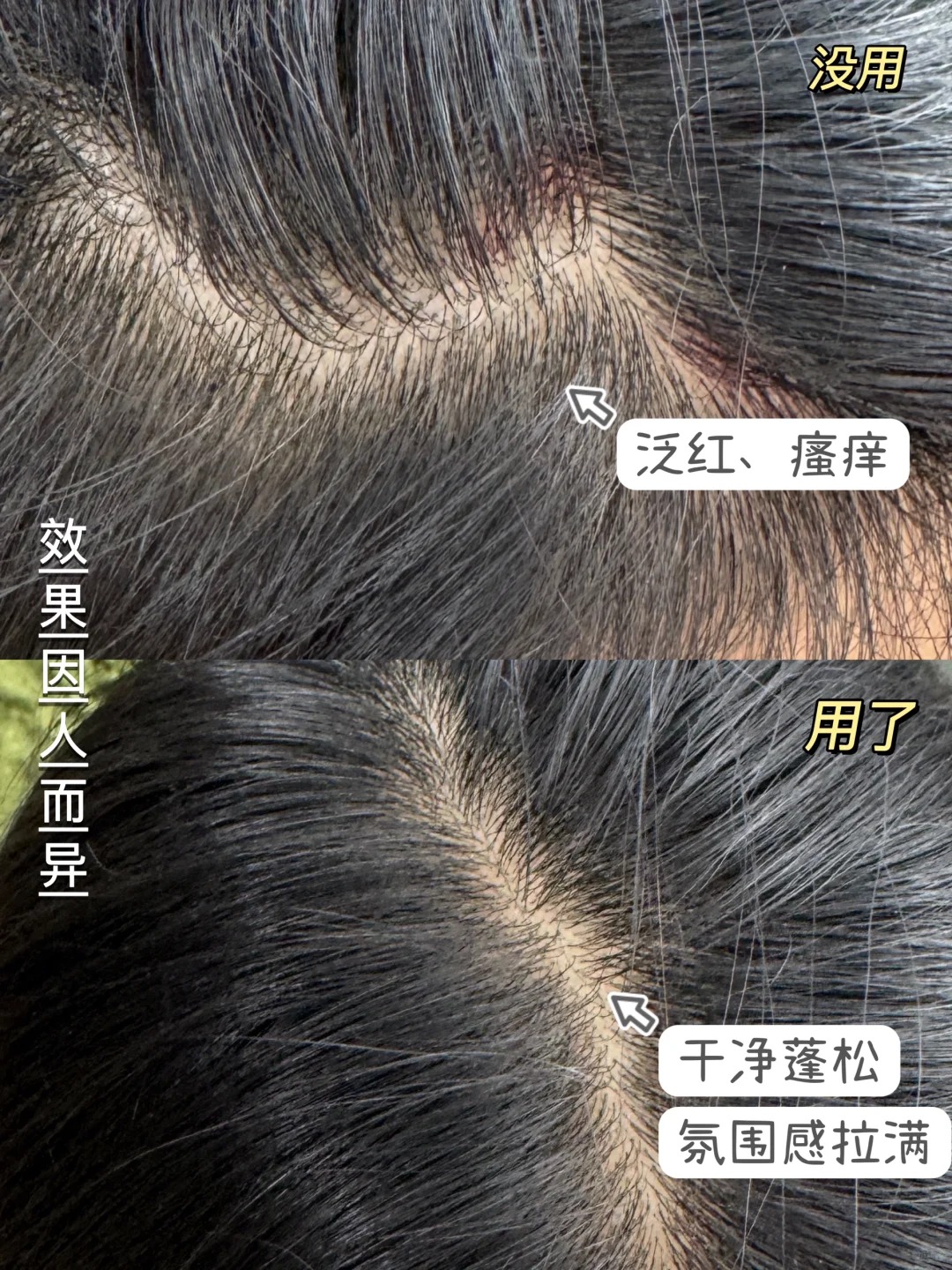 首先在洗发过程中它产生的泡沫非常丰富而细腻能够深入地清洁我的