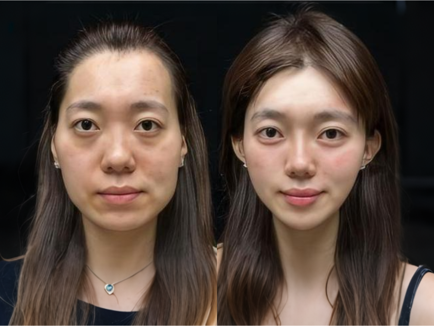 58万元,虽然不是一笔小数目,但看到效果后,我觉得每一分钱都花得值得