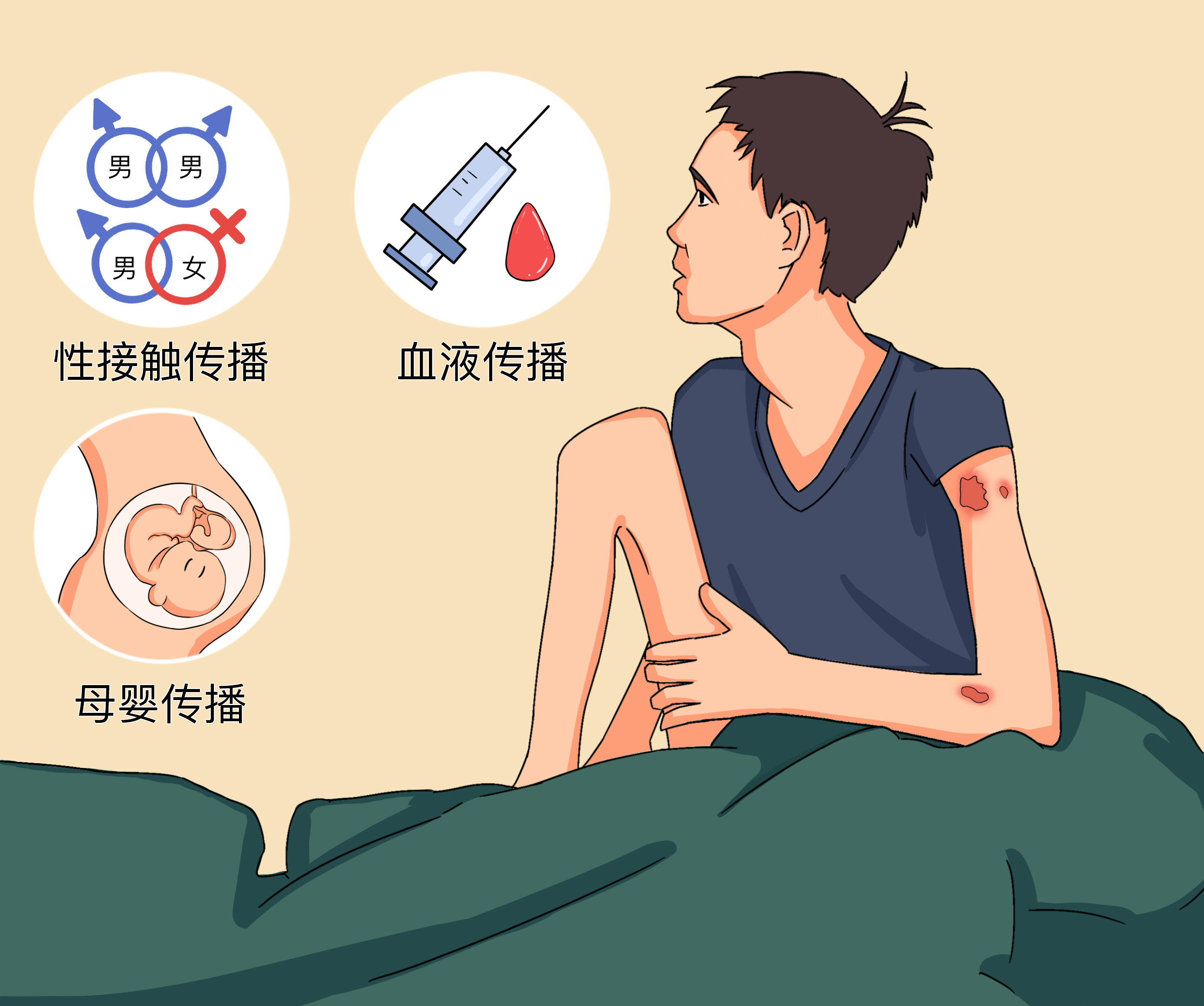 最终被判刑 最近,一起关于女子因感染艾滋病而故意与他人发生关系,并