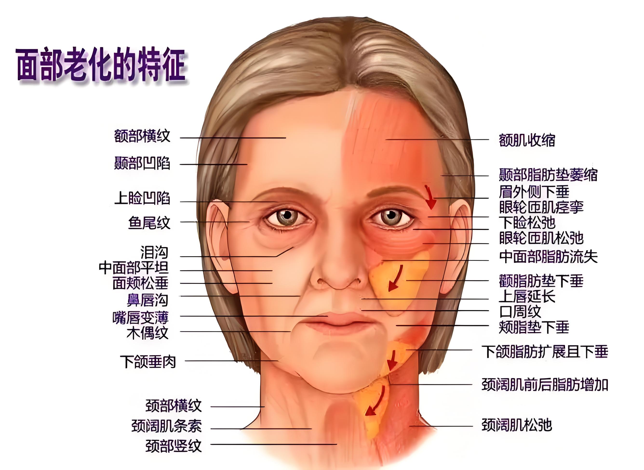 但针对提上唇肌面部肌肉解剖图面部肌肉结构图面部解剖位置名称图解
