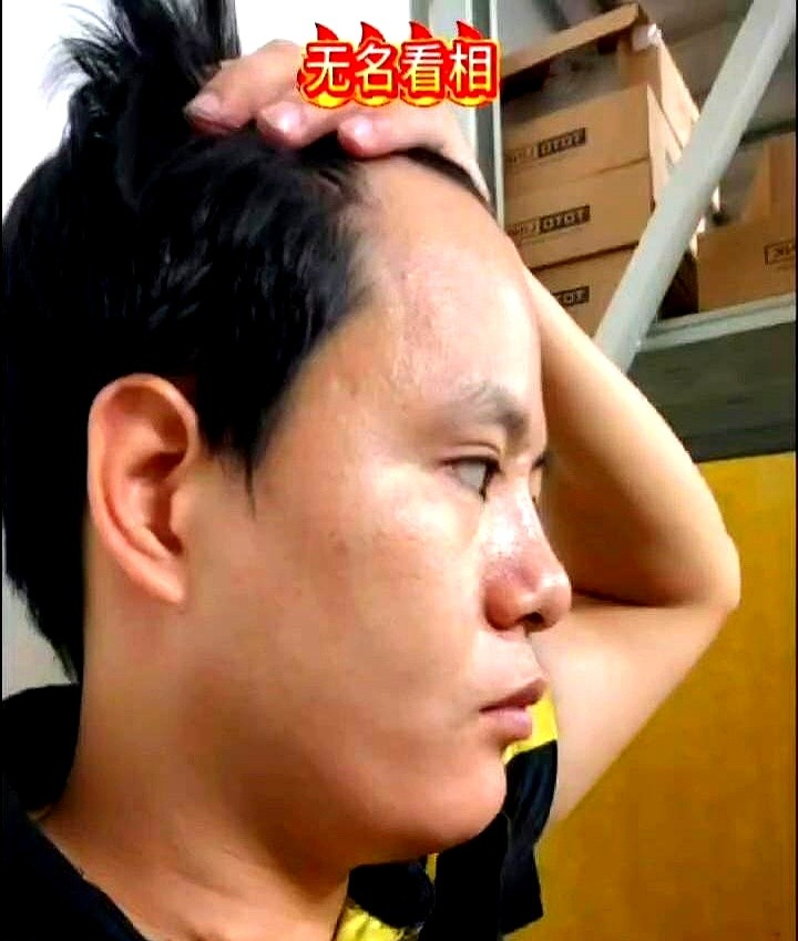 无耳垂,一生操劳