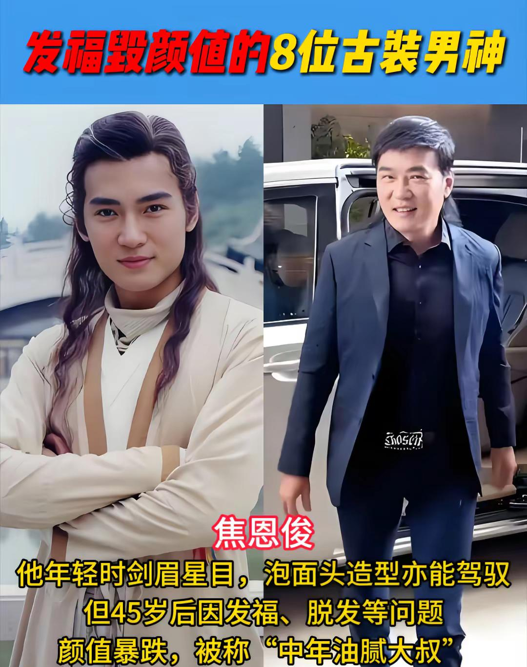 焦恩俊他年轻时剑眉星目,泡面头造型亦能驾驭,但45岁后因发福,脱发等