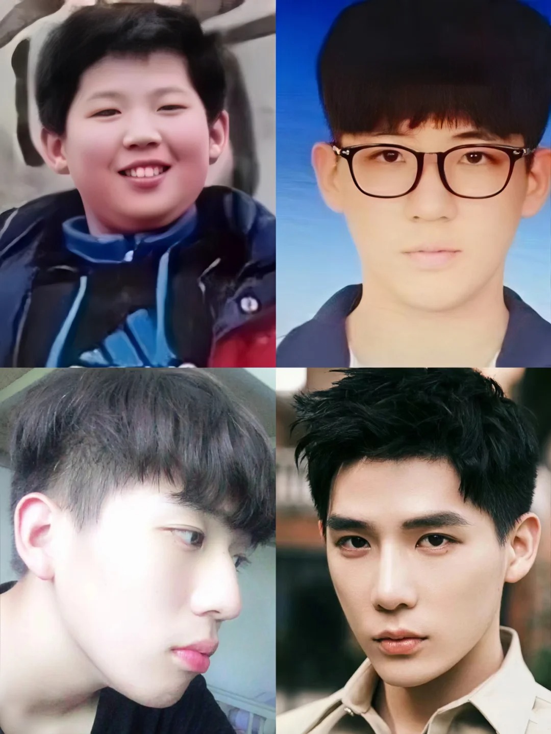 王安宇小时候王安宇胖瘦对比王安宇出道前的样子王安宇整容前后王安宇