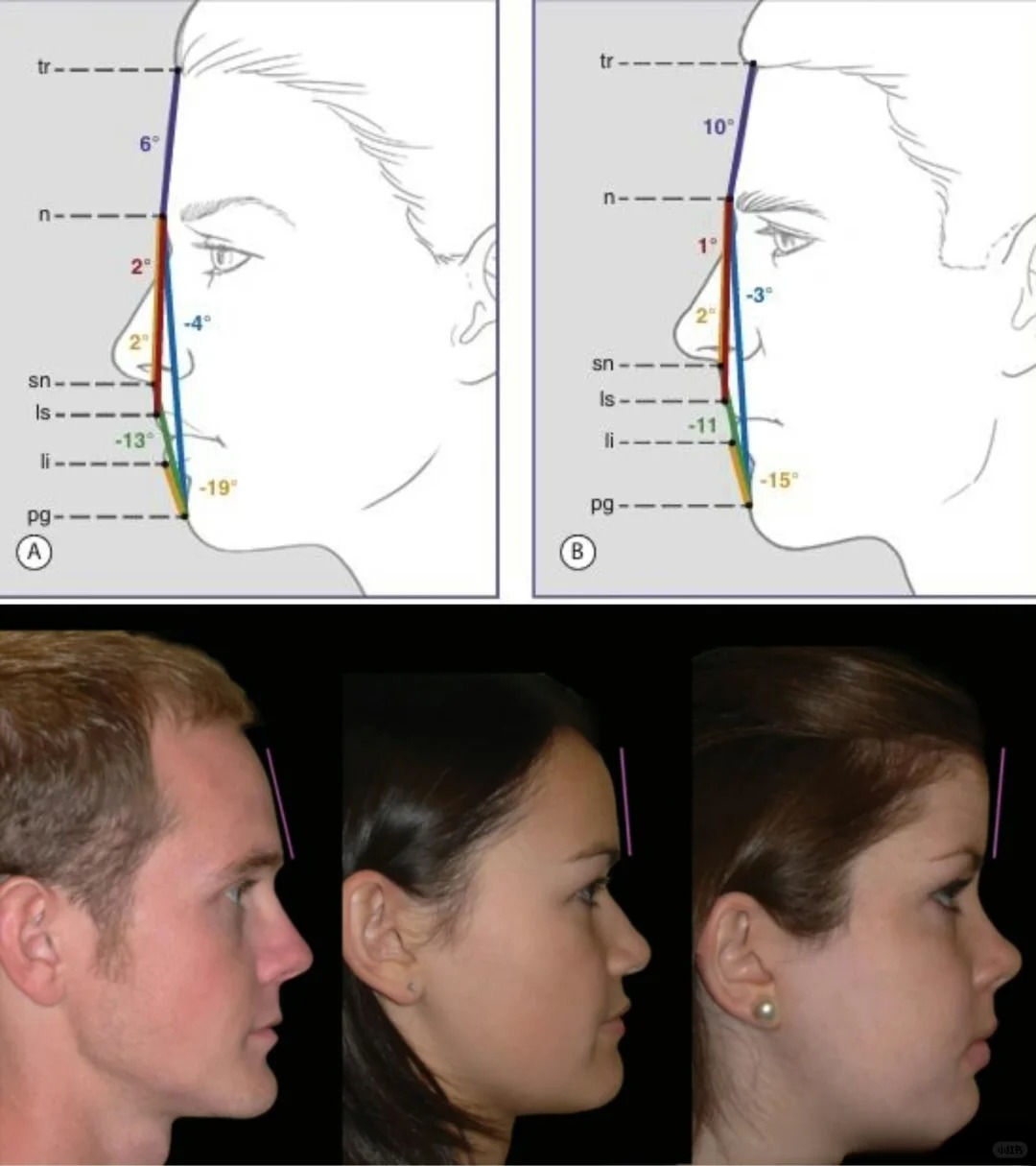 高级感大美女的额头都有一个四边形