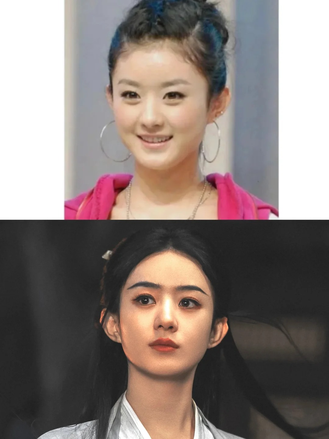 女明星明星艺美整容前后对比照没整过容的女明星承认做过小颜整骨的